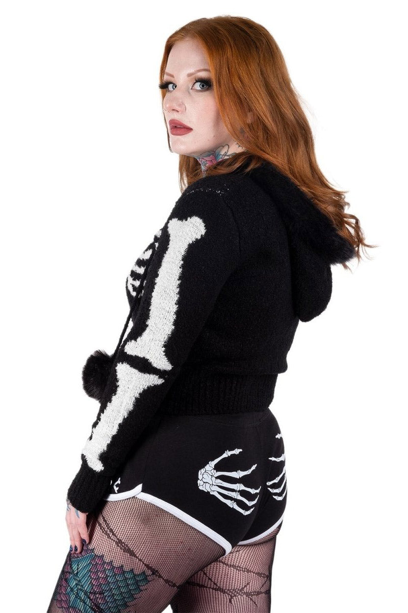 black skeleton hands emo shorts